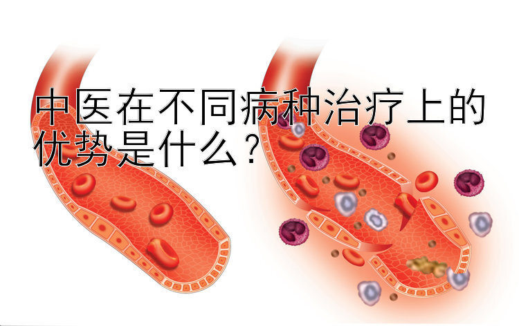 中医在不同病种治疗上的优势是什么？