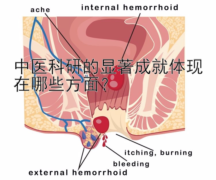 中医科研的显著成就体现在哪些方面？