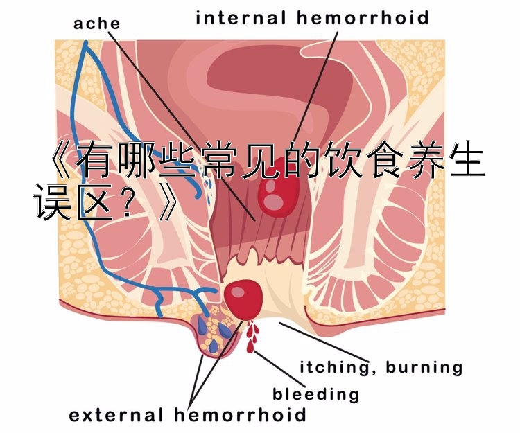 《有哪些常见的饮食养生误区？》