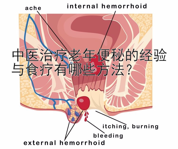 中医治疗老年便秘的经验与食疗有哪些方法？