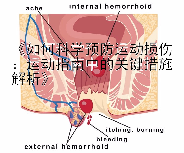 《如何科学预防运动损伤：运动指南中的关键措施解析》