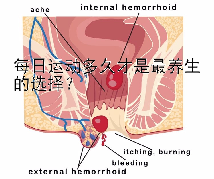 大发最高代理邀请码   每日运动多久才是最养生的选择？