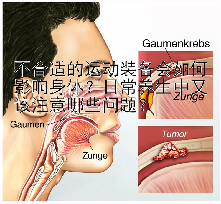 不合适的运动装备会如何影响身体？大发代理APP邀请码   日常养生中又该注意哪些问题？