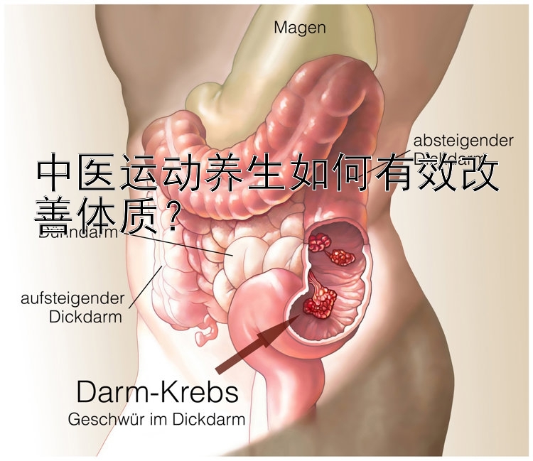 中医运动养生如何有效改善体质？